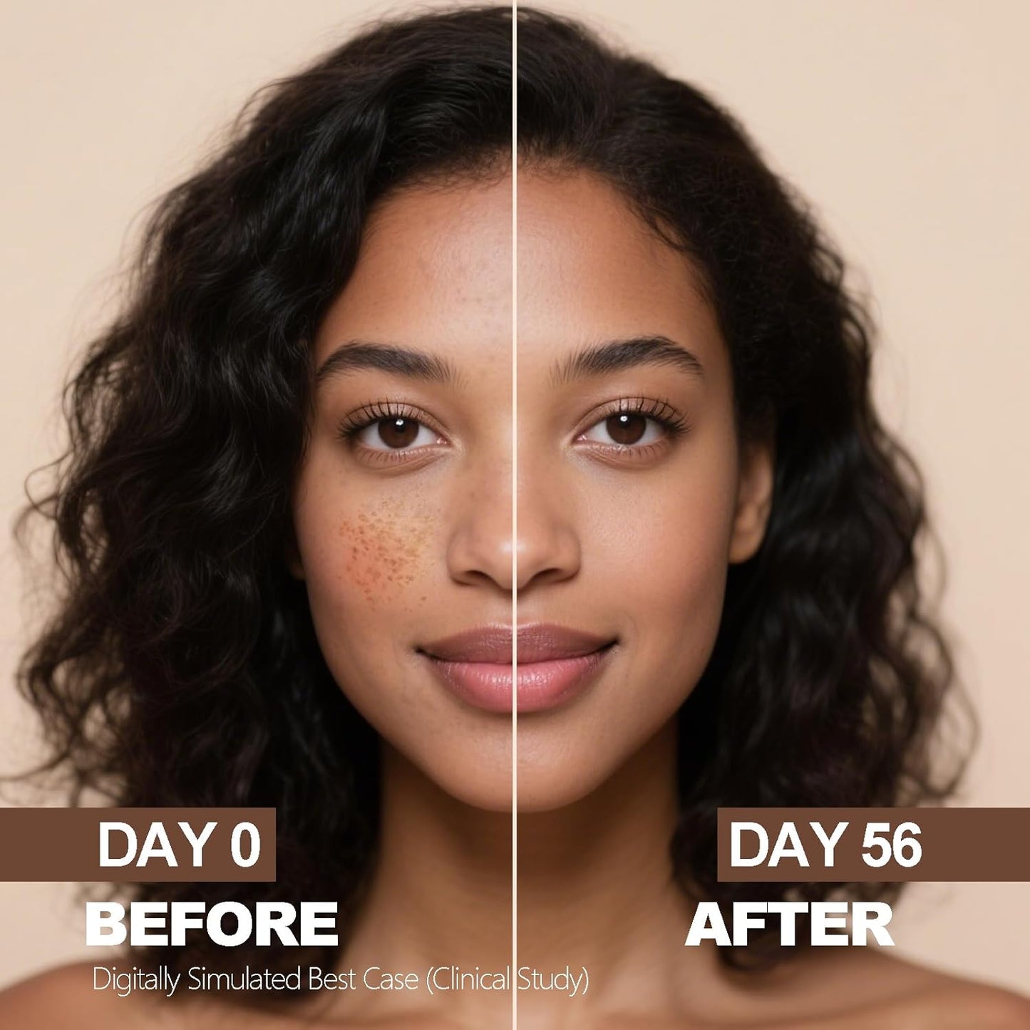 Aobenz Radiant Glow Dark Spot Corrector™