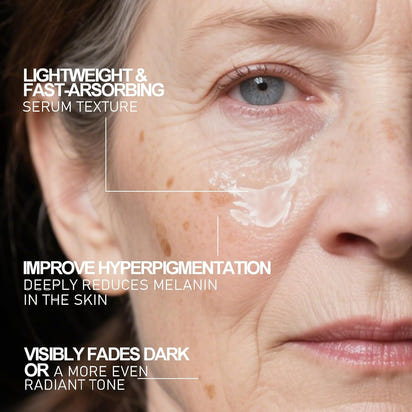 Aobenz Radiant Glow Dark Spot Corrector™