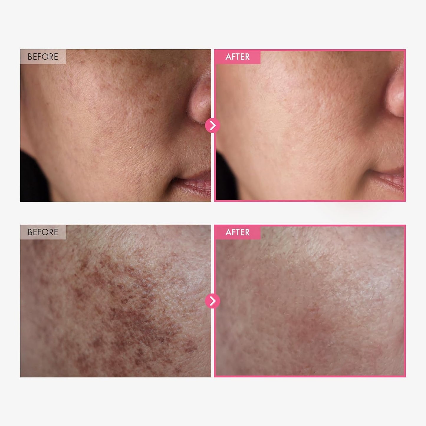 Luminous Skin Renewal Cream™