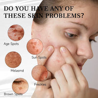 Aobenz Renewal Anti-Aging Cream TM