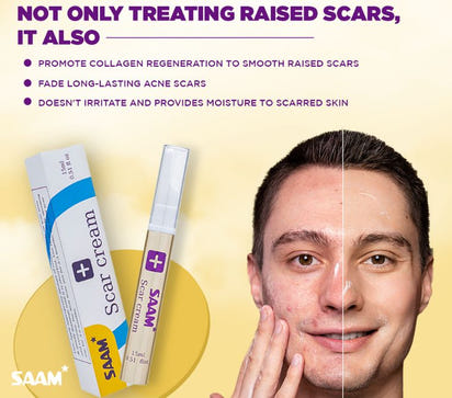 SAAM Scar Cream