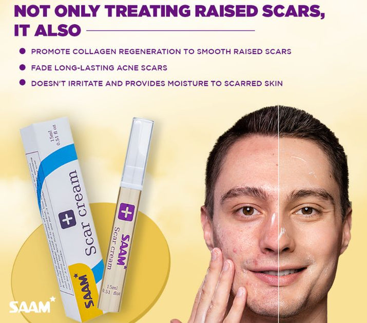 SAAM Scar Cream